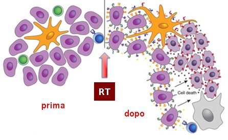 radioterapia e melanoma