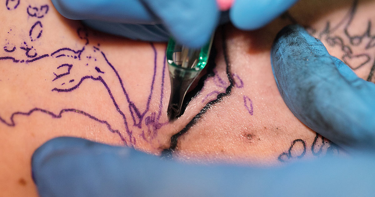 melanoma tatuaggiocopia